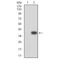 anti-HYAL1 antibody (Hyaluronidase-1) (N-Term)