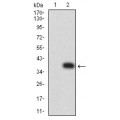 anti-HYAL1 antibody (Hyaluronidase-1) (N-Term)