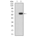 anti-HYAL1 antibody (Hyaluronidase-1) (N-Term)