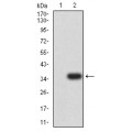 anti-HYAL1 antibody (Hyaluronidase-1) (N-Term)