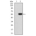 anti-HYAL1 antibody (Hyaluronidase-1) (N-Term)