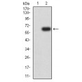 anti-HYAL1 antibody (Hyaluronidase-1) (N-Term)