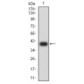 anti-HYAL1 antibody (Hyaluronidase-1) (N-Term)