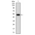 anti-HYAL1 antibody (Hyaluronidase-1) (N-Term)
