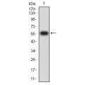 anti-HYAL1 antibody (Hyaluronidase-1) (N-Term)