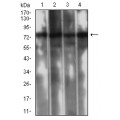 anti-HYAL1 antibody (Hyaluronidase-1) (N-Term)