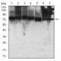 anti-HYAL1 antibody (Hyaluronidase-1) (N-Term)