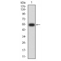 anti-HYAL1 antibody (Hyaluronidase-1) (N-Term)