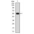 anti-HYAL1 antibody (Hyaluronidase-1) (N-Term)