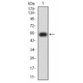 anti-HYAL1 antibody (Hyaluronidase-1) (N-Term)