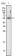 ETV4 Primary Antibody MP20236 [M1A2G3]