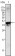 Androgen receptor Primary Antibody MP30007 [M2H8]