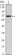 FAK Primary Antibody MP30053 [M10H7E9]