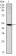 SMAD2 Primary Antibody MP30242 [M5G7]