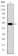 GCK Primary Antibody MP30243 [M4G6]