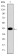KRT19 Primary Antibody MP30249 [M4E8]