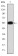 MMP9 Primary Antibody MP30253 [M5C3]