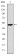 KID Primary Antibody  MP30277 [M1E3]