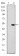 GCK Primary Antibody MP30243 [M4G6]
