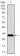 SLC27A5 Primary Antibody MP30454P  [M4B11C10]