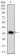 ABCB1 Primary Antibody MP30593 [M6G11F8]