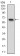 RPS6KA2 Primary Antibody MP30694 [M3C4C8]