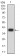 KAT2B Primary Antibody MP31630  [M7D12C8]