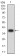 SIRT2 Primary Antibody MP31704 [M5H11H9]