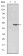 MTHFR Primary Antibody MP30204 [M5D3]