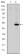 MMP1 Primary Antibody MP30236 [M6A5]