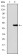 KID Primary Antibody  MP30277 [M1E3]