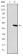 TNNI2 Primary Antibody MP30278 [M2F12A8]