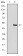 MAP2K5 Primary Antibody  MP30650T [M5H11B10]