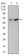 PLK1 Primary Antibody MP30396 [M3C11]