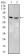 SLC27A5 Primary Antibody MP30454P  [M4B11C10]