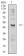 CHRND Primary Antibody MP31349 [M1H1F9]