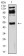CD119 Primary Antibody MP31384 [M3E1A9]