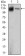 KIF11 Primary Antibody MP20442 [M3B7B2]