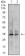 CDK4 Primary Antibody MP20445 [M4C5H9]