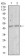 MEF2C Primary Antibody MP30439 [M6H2G2]