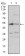 DAPK3 Primary Antibody MP30634 [M4H4C8]