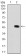 MAP1LC3B Primary Antibody MP30363 [M5H12]