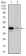 PAX5 Primary Antibody MP30379 [M1A7]
