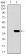 SLC27A5 Primary Antibody MP30454A [M4B11C10]
