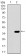 SLC27A5 Primary Antibody MP30454P  [M4B11C10]