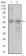 GNL3 Primary Antibody MP30458A [M2C8D5]