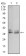 ACP5 Primary Antibody MP30508 [M5C5E7]