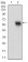 EPCAM Primary Antibody  MP30630T [M7B5C10]