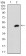 MEN1 Primary Antibody MP30671T [M7D3E10]