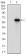 VIL1 Primary Antibody MP30692 [M5E3B2]